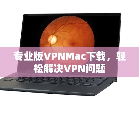 专业版VPNMac下载，轻松解决VPN问题